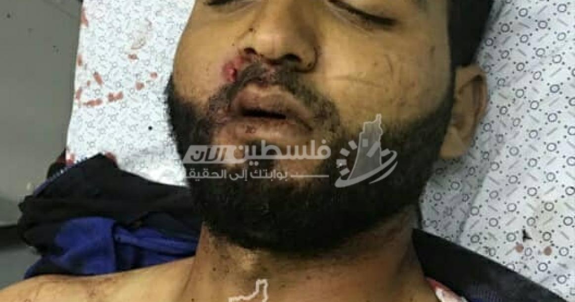 شهيدان برصاص الاحتلال شرق خزاعة شرق خانيونس