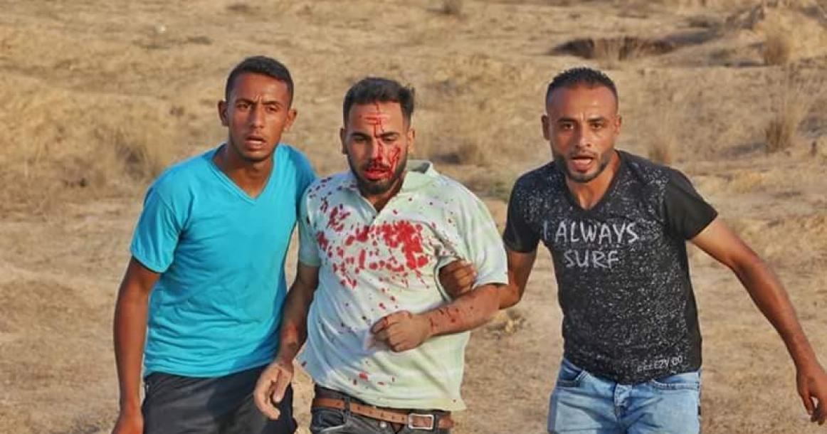 إصابة عدد من المواطنين بالمواجهات شرق كيسوفيم