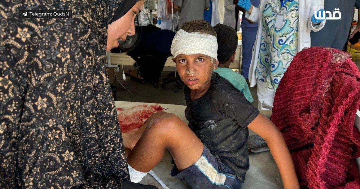 أطفال جرحى وصولوا المشفى بعد مجزرة الاحتلال باستهداف خيام النازحين في خانيونس.