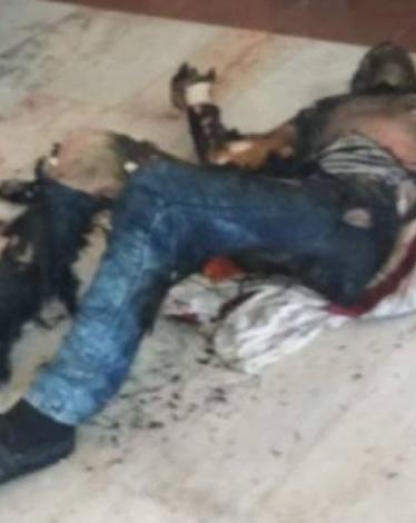 شاب يحاول الانتحار بإشعال النار في جسده غرب غزة