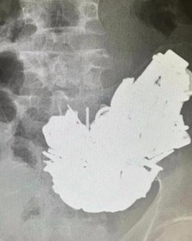 cc167e9e-54c7-469e-816f-4582ce7cc92e (1)