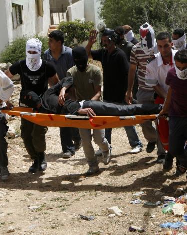 إصابة متضامن بقمع الاحتلال مسيرة كفر قدوم