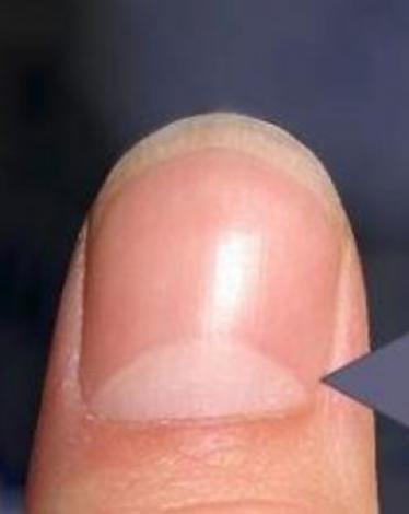 ماذا يعني هذا الهلال الأبيض على الأظافر؟