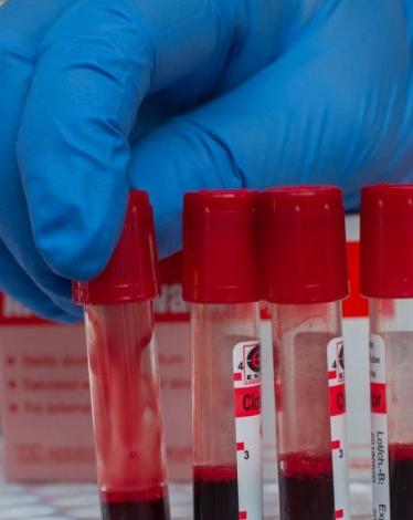 GettyImages-1161833987-2-1024x570