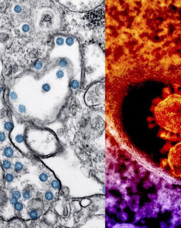 5e6e02824c59b74d174a1686