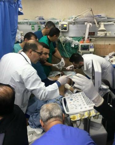 إصابة شاب خلال تصدي أهالي قصرة لاقتحام مستوطنين للبلدة