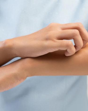 ما هي الصدفية وما علاجها؟