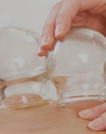 فوائد الحجامة الوقائية والعلاجية لا تحصى!