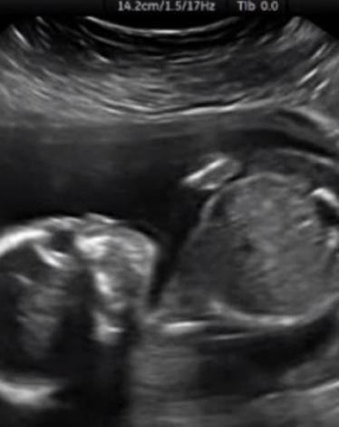 capture11-jpg-81032195888444523