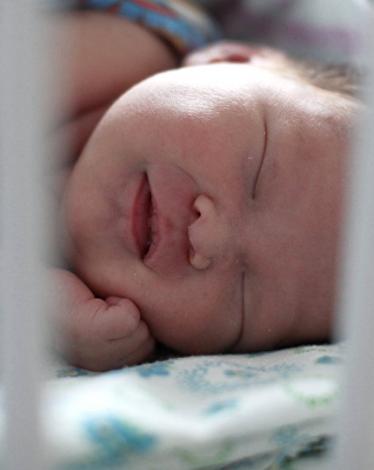 طفلة تولد مرتين بأمريكا