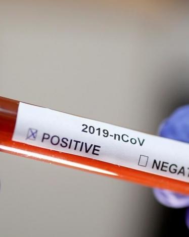 FILE PHOTO Test tube with Corona virus name label is seen in this illustration taken on January 29, 2020. REUTERS OK