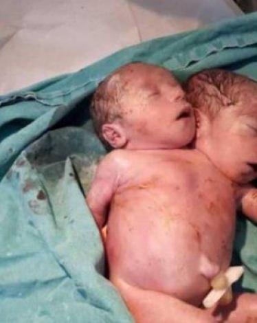 12182336884585022125233833877311