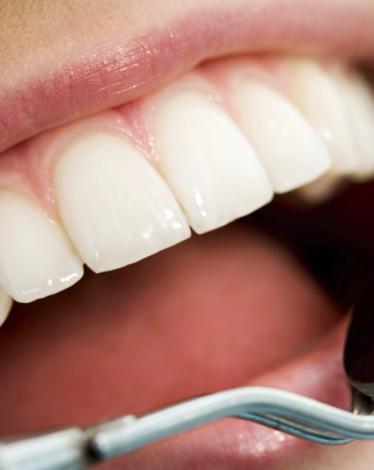 oral-health