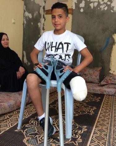 الاحتلال يحرم أطفالنا أحلامهم ويسعى لتحويلهم إلى معاقين