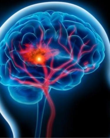 خلايا جذعية