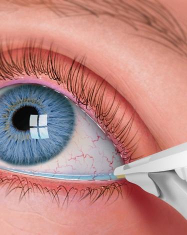 47sec_Eye