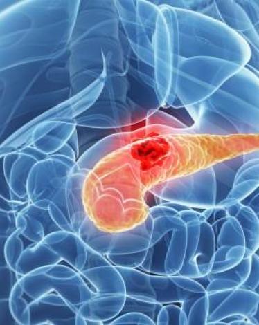 caf0a617-a65b-4930-abd7-015dd70cc6ca