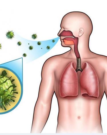 هل يمكن علاج التهاب الشعب الهوائية بالعسل؟