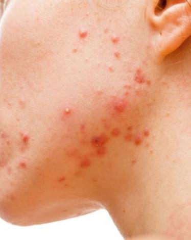 shutterstock_177851702