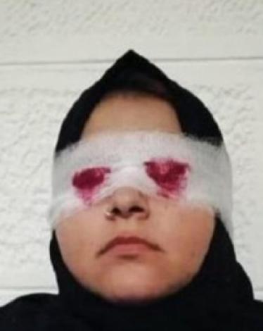 تفاصيل مروّعة جديدة عن مقتلع عيني زوجته بالأردن
