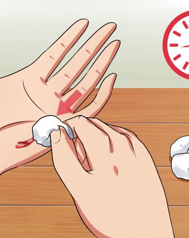 Heal-Cuts-Quickly-(Using-Easy,-Natural-Items)-Step-3-Version-4