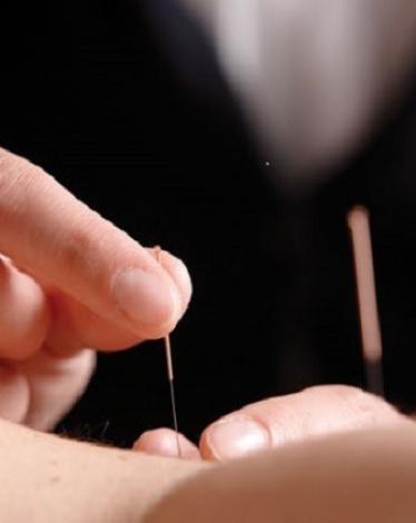 بعد مضي آلاف السنين على اختراع علاج الوخز بالإبر، ما يزال هناك جدل كبير حول آلية عمل 