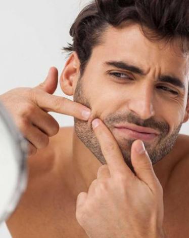 pimples