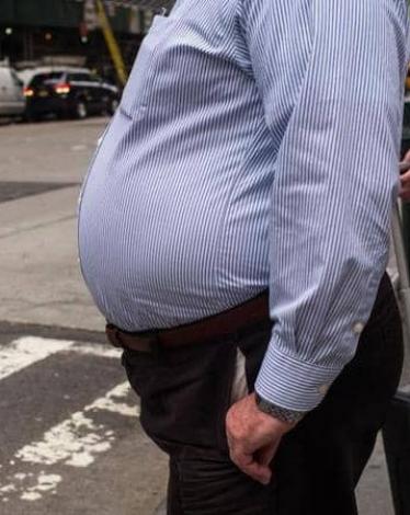 ملاحظة من إيطاليا.. ما علاقة السمنة بإصابات كورونا الخطيرة؟