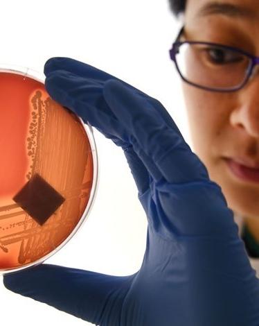 فيروس كورونا غير معدٍ بعد 11 يوما من الإصابة