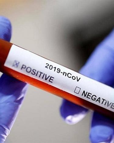 اختبار جديد لكورونا يكتشف الفيروس في 30 دقيقة