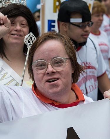 متلازمة داون هي الحالة الوراثية الأكثر شيوعا التي يتم تشخيصها في الولايات المتحدة كل عام