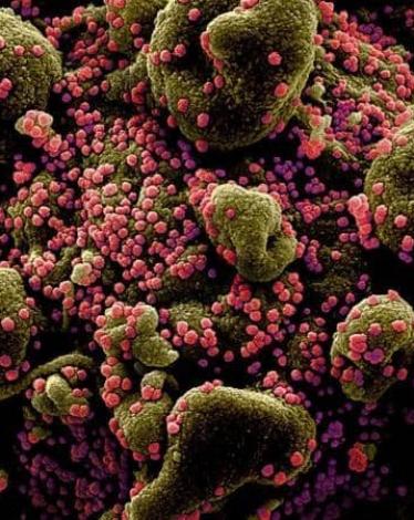 جزيئات فيروس كورونا باللون الأحمر تهاجم خلية بشرية