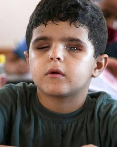 محمد شعبان.. طفل دمر الاحتلال حياته وأحلامه بعد فقدان نظره