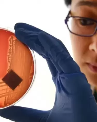 اكتشاف خلية جديدة بوظائف متعلقة بالشفاء تم التنبؤ بها منذ 100 عام