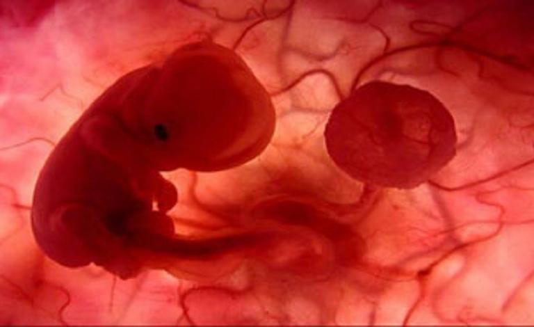 580c4dd8c361885d3d8b45b1