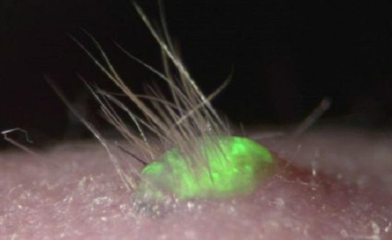 صورة للعملية