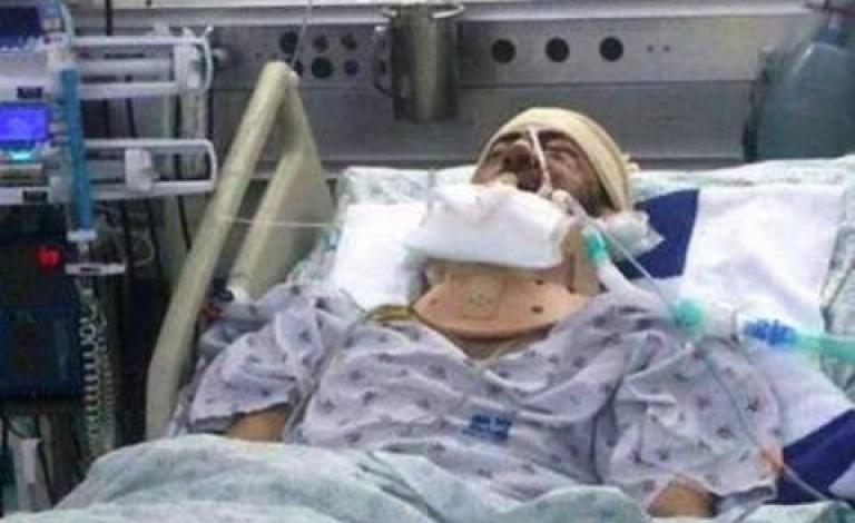 شلالدة