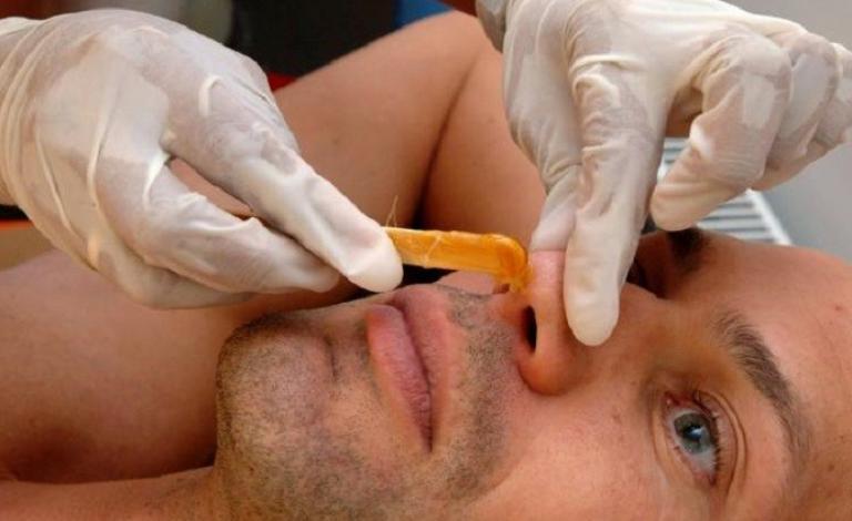 إزالة شعر الأنف