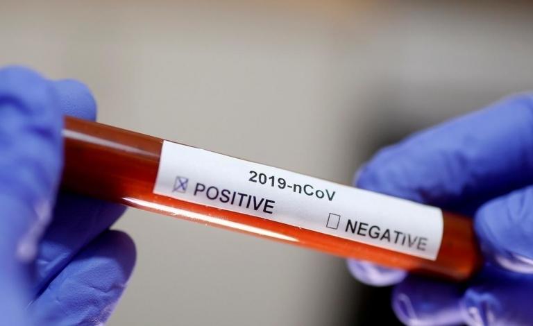 FILE PHOTO Test tube with Corona virus name label is seen in this illustration taken on January 29, 2020. REUTERS OK (1)