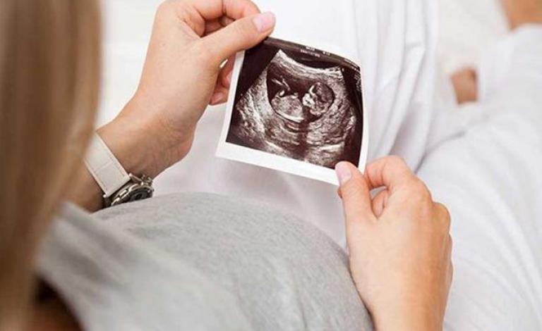 b60acf8957362832da94b714fbc33f658ab3dbfe