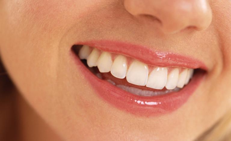 perfect-teeth