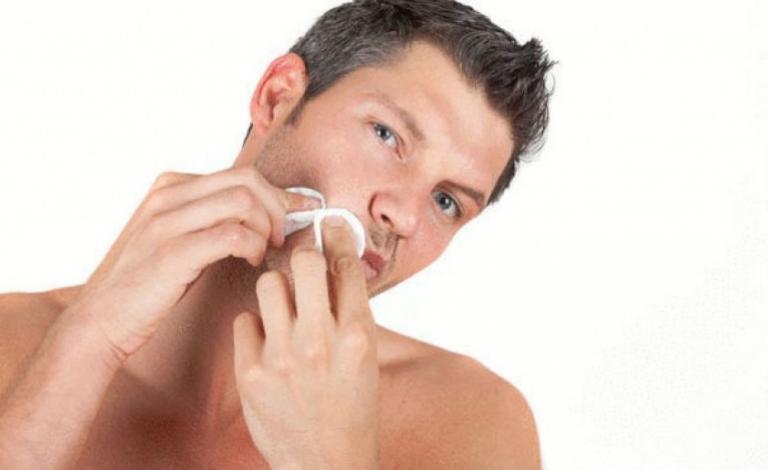 طرق سريعة للتخلص من آثار حب الشباب