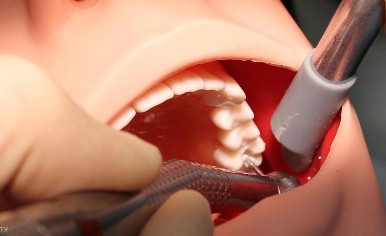 حشو  الأسنان