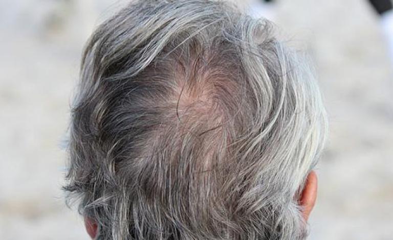 White-hair
