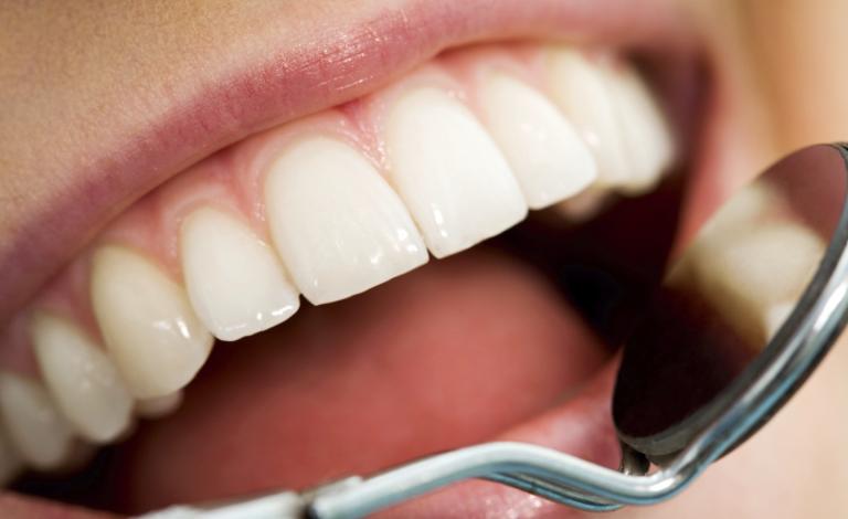 oral-health