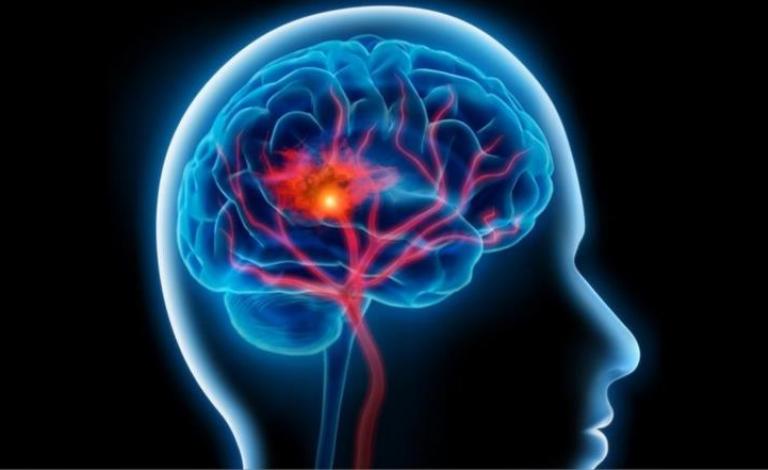 خلايا جذعية