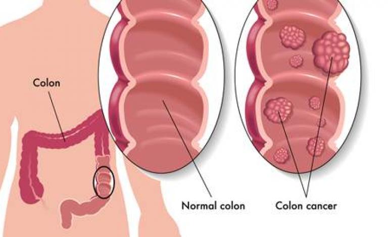 tbl_diseases_disease_24_553