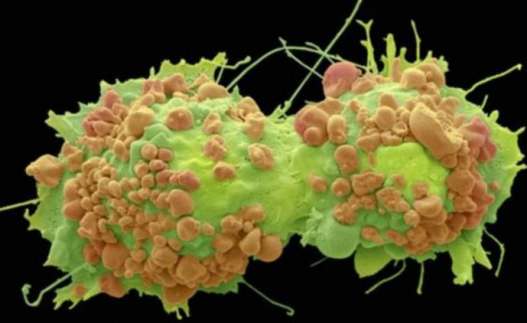 150826111615_cancer_cells_640x360_bbc_nocredit