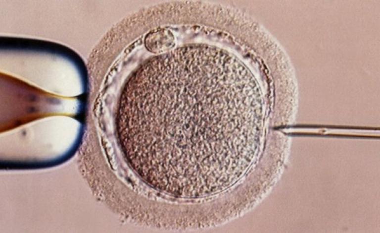 _106404659_hi037942123