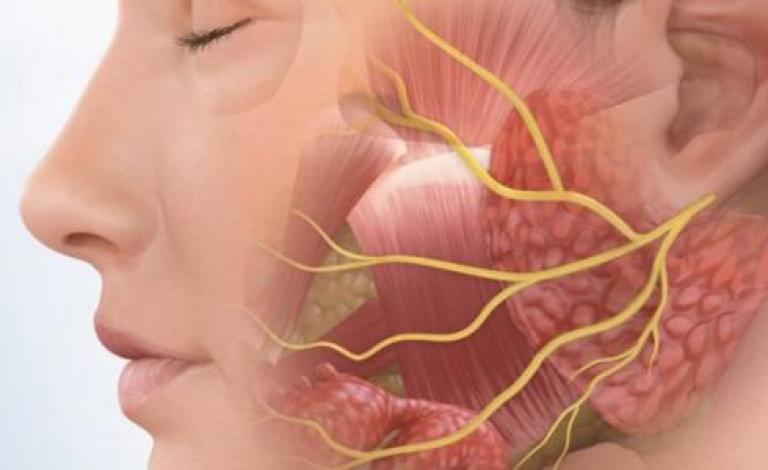 ما_علاج_العصب_السابع